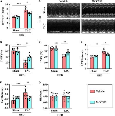 MCC950, a Selective NLRP3 Inhibitor, Attenuates Adverse Cardiac Remodeling Following Heart Failure Through Improving the Cardiometabolic Dysfunction in Obese Mice